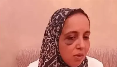 مالكة عقار في المنصورة تكشف تفاصيل اعتداء وسحل تعرضت له من قبل 3 مستأجرين بسبب خلاف حول الإيجار