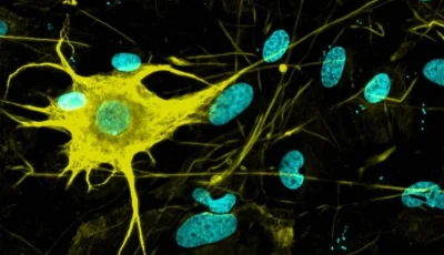 Cultivating Brain Cells in the Laboratory for Treating Alzheimer’s and Parkinson’s Diseases